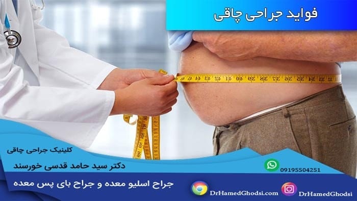 از فواید عمل چاقی می توان به کاهش چربی شکم اشاره کرد.