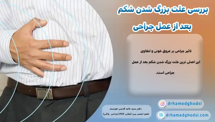 چاقی بعد از جراحی لاغری