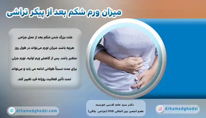 چاقی بعد از جراحی لاغری
