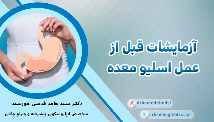 آزمایشات قبل از عمل اسلیو معده
