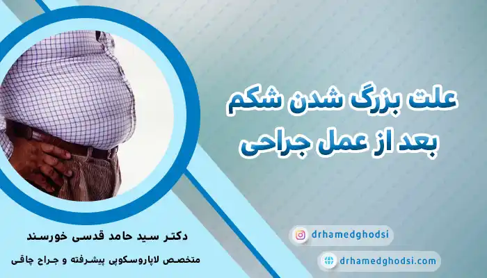 چاقی بعد از جراحی لاغری