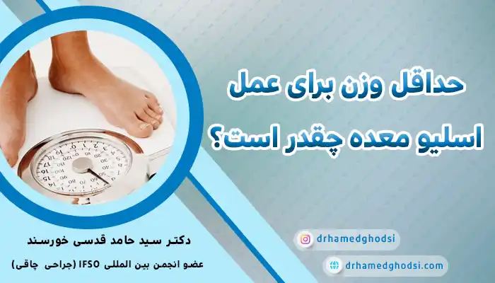 حداقل وزن برای عمل اسلیو معده