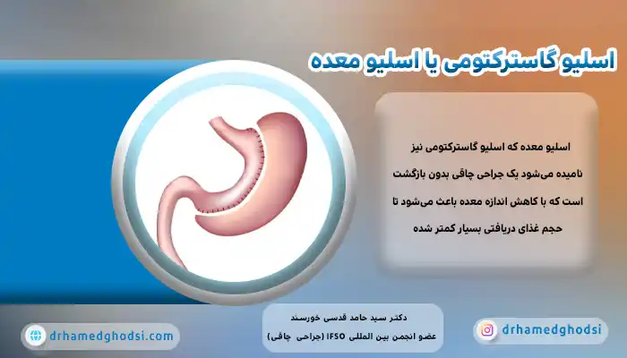 عمل جراحی اسلیو گاسترکتومی