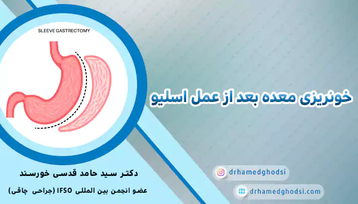 خونریزی معده بعد از عمل اسلیو 