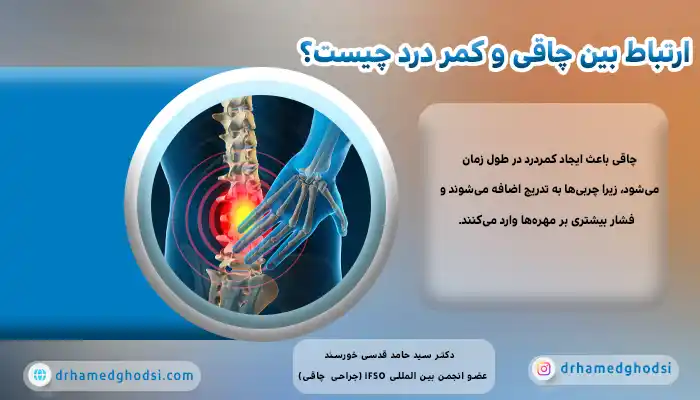ارتباط بین چاقی و کمر درد چیست