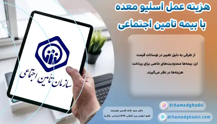 هزینه اسلیو معده با بیمه تامین اجتماعی