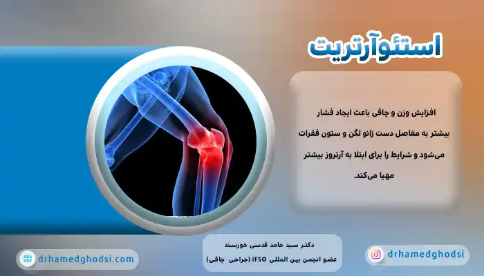 استئوآرتریت یکی از بیماریهای مرتبط با چاقی است.