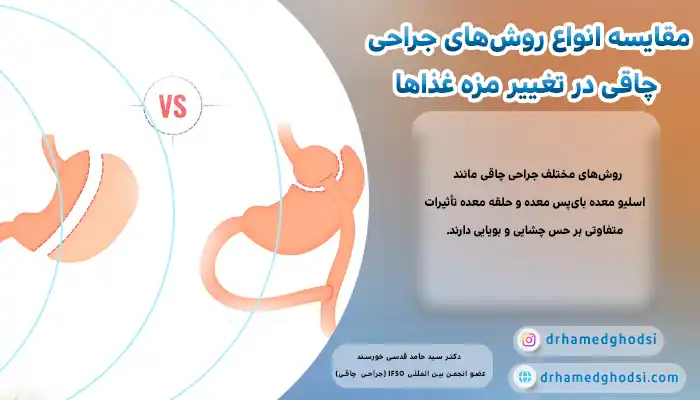 مقایسه انواع روشهای جراحی چاقی در تغییر مزه غذاها