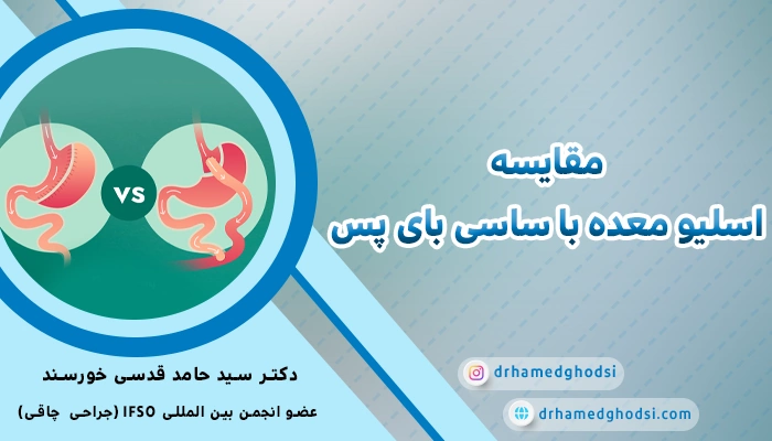 مقایسه اسلیو معده با ساسی بای پس