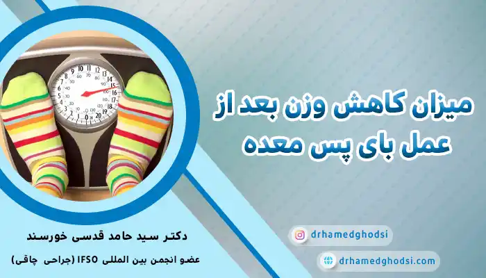روند کاهش وزن بعد از عمل بای پس