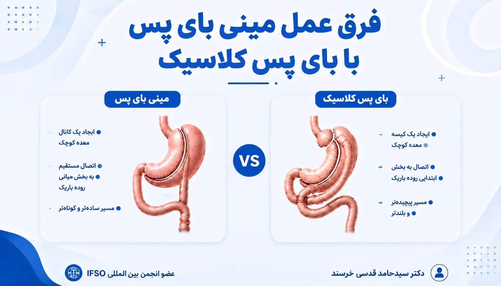 فرق عمل مینی بای پس با بای پس کلاسیک
