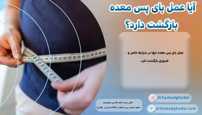 برگرداندن عمل بای پس معده