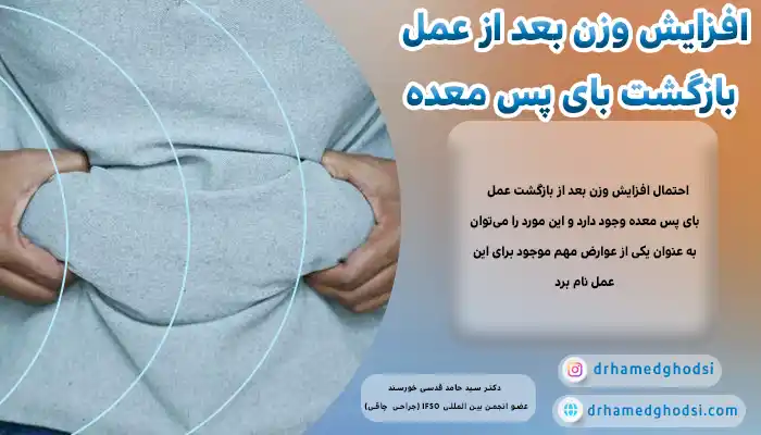 افزایش وزن بعد از عمل بازگشت بای پس معده