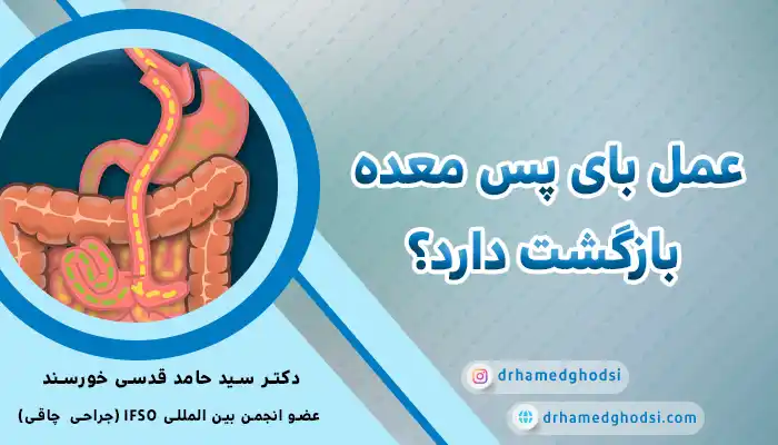 برگشت پذیری بای پس معده