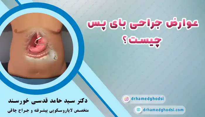 عوارض بای پس معده