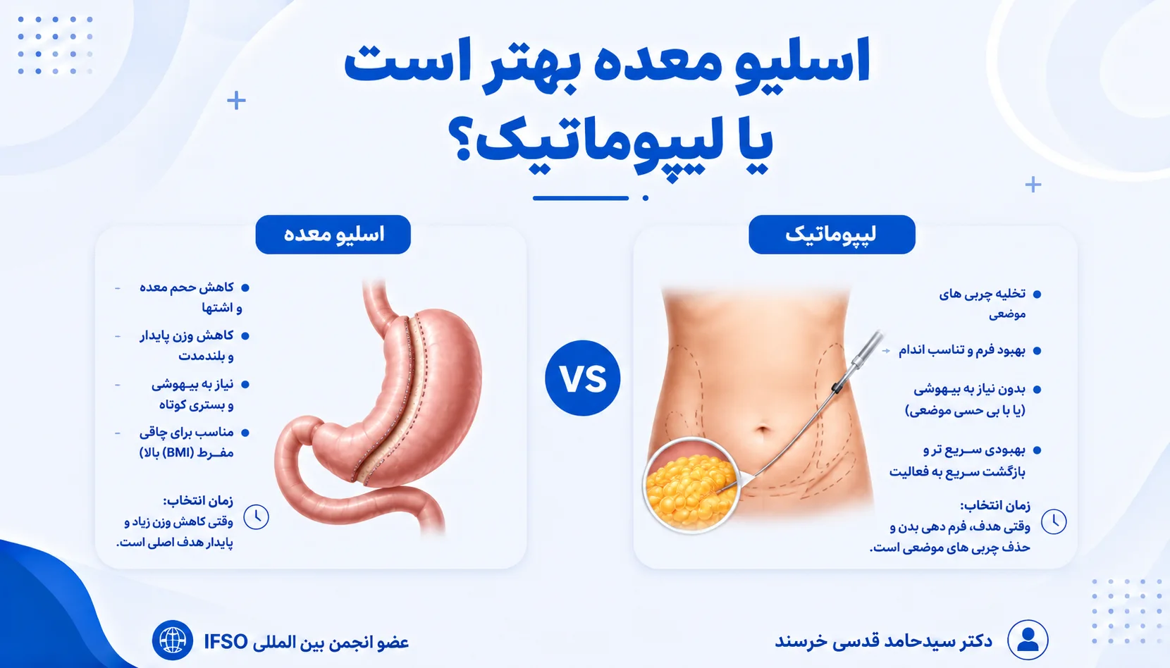 تفاوت اسلیو معده و لیپوماتیک