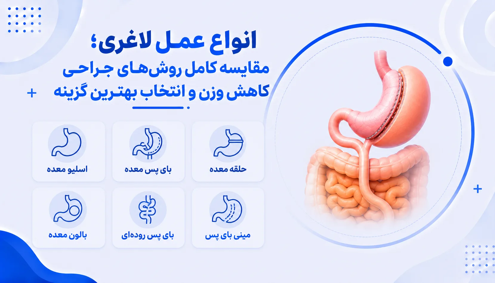 انواع عمل لاغری