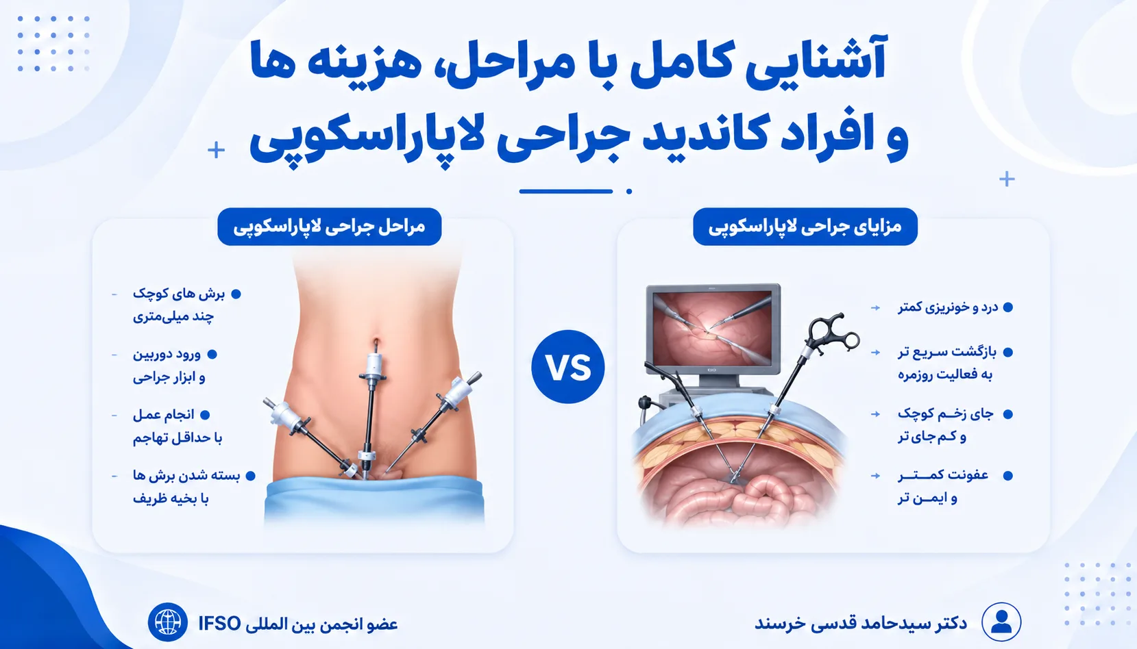 آشنایی با مراحل، مزایا و افراد کاندید جراحی لاپاراسکوپی